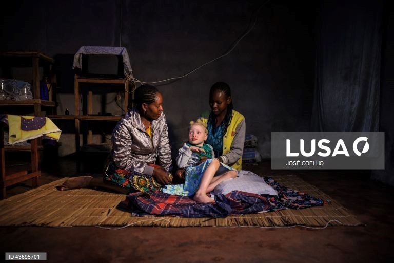 Ana (C), que nasceu com albinismo, uma condição de ausência de melanina na pele, nos olhos e nos cabelos, acompanhada pela mãe, Marta Mafusa (E), no Chimoio, Moçambique, 01 de outubro de 2024. Em Moçambique, e em países fronteiriços, há quem acredite que as partes do corpo de pessoas albinas podem ter poderes mágicos para a vida material e espiritual. Segundo estudos académicos, os dedos das mãos, por exemplo, representam a posse e os órgãos sexuais a fertilidade. E os curandeiros africanos...