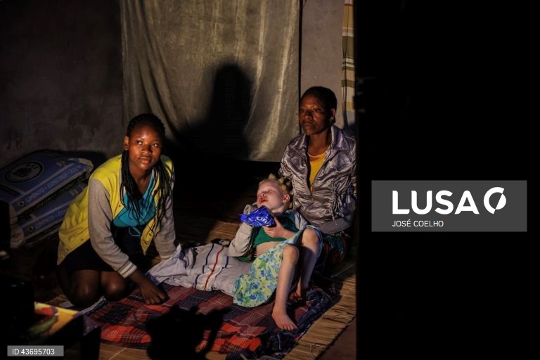 Ana (C), que nasceu com albinismo, uma condição de ausência de melanina na pele, nos olhos e nos cabelos, repousa nos braços da mãe, Marta Mafusa (D), no Chimoio, Moçambique, 01 de outubro de 2024. Em Moçambique, e em países fronteiriços, há quem acredite que as partes do corpo de pessoas albinas podem ter poderes mágicos para a vida material e espiritual. Segundo estudos académicos, os dedos das mãos, por exemplo, representam a posse e os órgãos sexuais a fertilidade. E os curandeiros...