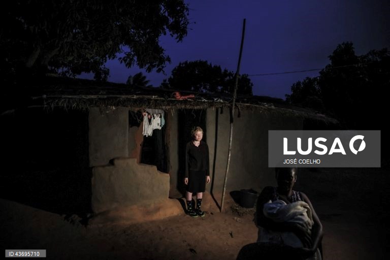 Inês, abandonada pela mãe, diz que não sente falta da mulher que lhe deu vida, mas tem pena de não ir mais à escola, no Chimoio, Moçambique, 01 de outubro de 2024. Inês, tem o pai e as tias, preocupados com um possível sequestro. Em Moçambique, e em países fronteiriços, há quem acredite que as partes do corpo de pessoas albinas podem ter poderes mágicos para a vida material e espiritual. Segundo estudos académicos, os dedos das mãos, por exemplo, representam a posse e os órgãos sexuais a...