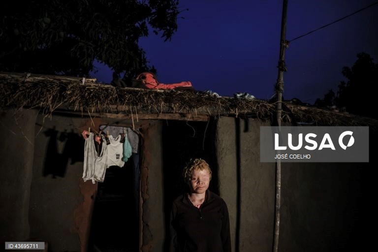 Inês, abandonada pela mãe, diz que não sente falta da mulher que lhe deu vida, mas tem pena de não ir mais à escola, no Chimoio, Moçambique, 01 de outubro de 2024. Inês, tem o pai e as tias, preocupados com um possível sequestro. Em Moçambique, e em países fronteiriços, há quem acredite que as partes do corpo de pessoas albinas podem ter poderes mágicos para a vida material e espiritual. Segundo estudos académicos, os dedos das mãos, por exemplo, representam a posse e os órgãos sexuais a...