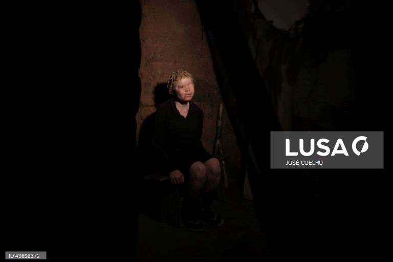 Inês, abandonada pela mãe, diz que não sente falta da mulher que lhe deu vida, mas tem pena de não ir mais à escola, no Chimoio, Moçambique, 01 de outubro de 2024. Inês, tem o pai e as tias, preocupados com um possível sequestro. Em Moçambique, e em países fronteiriços, há quem acredite que as partes do corpo de pessoas albinas podem ter poderes mágicos para a vida material e espiritual. Segundo estudos académicos, os dedos das mãos, por exemplo, representam a posse e os órgãos sexuais a...