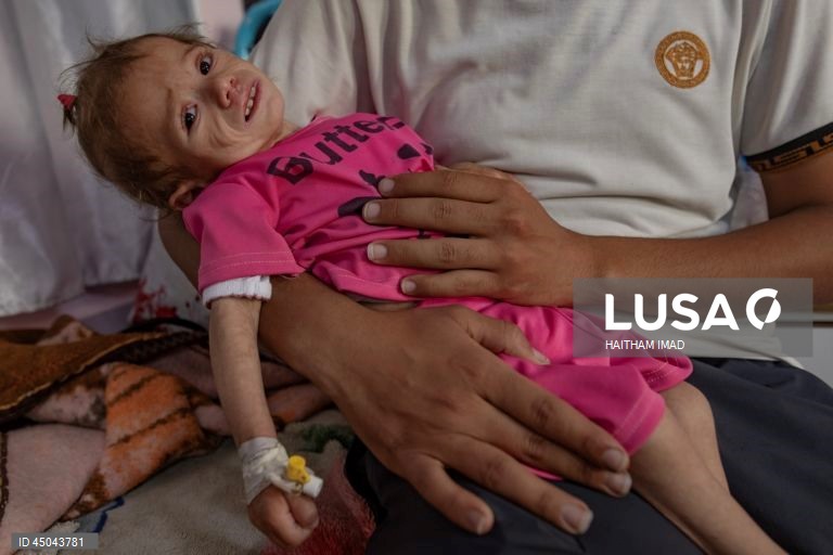 Faixa de Gaza: Tratamento de crianças desnutridas em Khan Yunis