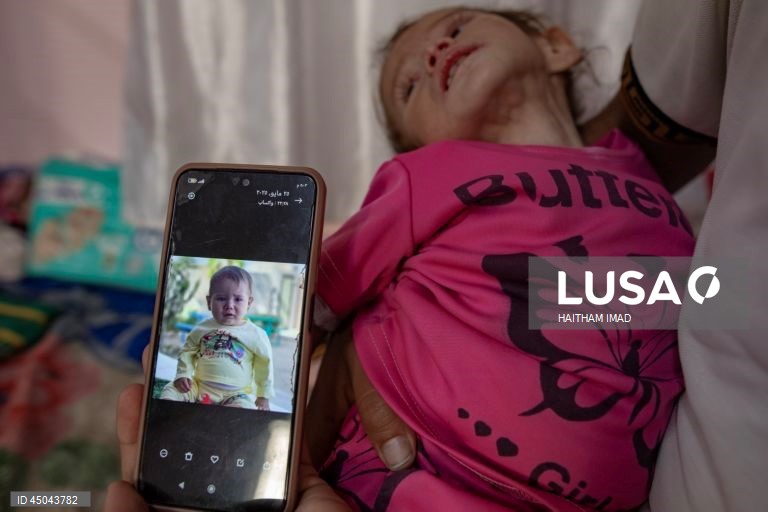 Faixa de Gaza: Tratamento de crianças desnutridas em Khan Yunis