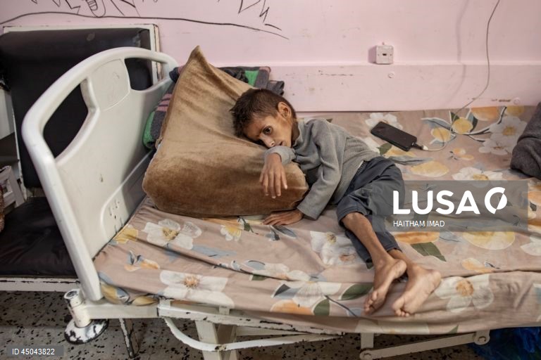 Faixa de Gaza: Tratamento de crianças desnutridas em Khan Yunis