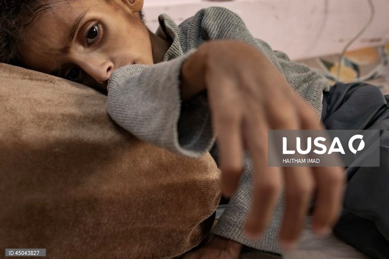 Faixa de Gaza: Tratamento de crianças desnutridas em Khan Yunis