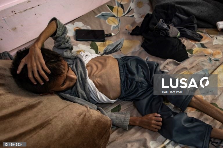 Faixa de Gaza: Tratamento de crianças desnutridas em Khan Yunis