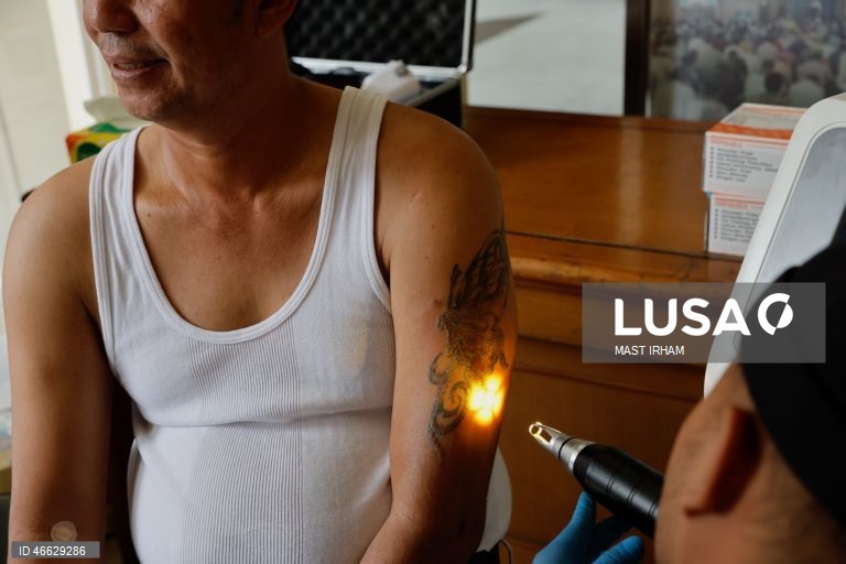 Indonésia: Programa gratuito de remoção de tatuagens durante o Ramadão em Jacarta