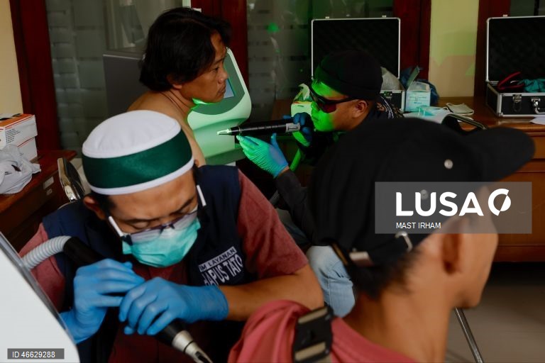 Indonésia: Programa gratuito de remoção de tatuagens durante o Ramadão em Jacarta