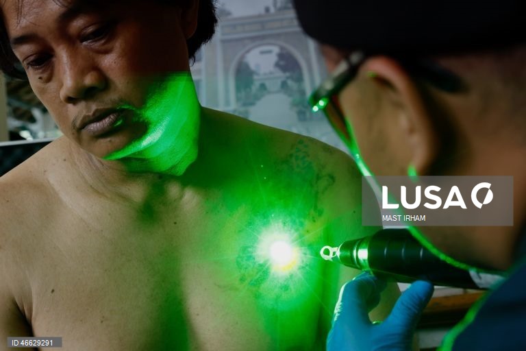 Indonésia: Programa gratuito de remoção de tatuagens durante o Ramadão em Jacarta