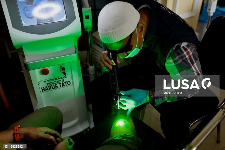 Indonésia: Programa gratuito de remoção de tatuagens durante o Ramadão em Jacarta