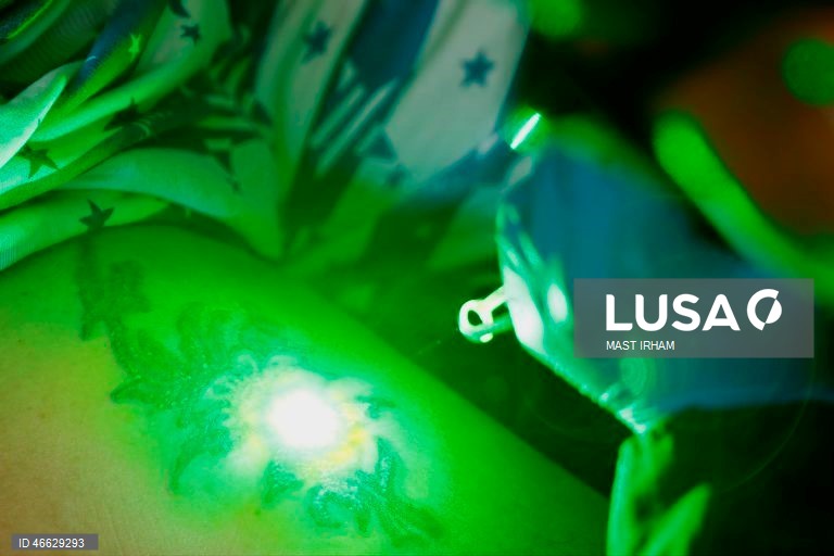 Indonésia: Programa gratuito de remoção de tatuagens durante o Ramadão em Jacarta