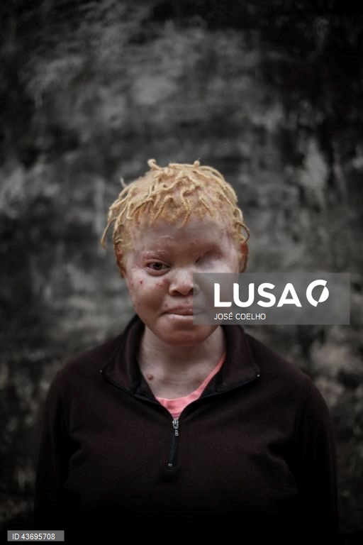 Inês, abandonada pela mãe, diz que não sente falta da mulher que lhe deu vida, mas tem pena de não ir mais à escola, no Chimoio, Moçambique, 01 de outubro de 2024. Inês, tem o pai e as tias, preocupados com um possível sequestro. Em Moçambique, e em países fronteiriços, há quem acredite que as partes do corpo de pessoas albinas podem ter poderes mágicos para a vida material e espiritual. Segundo estudos académicos, os dedos das mãos, por exemplo, representam a posse e os órgãos sexuais a...
