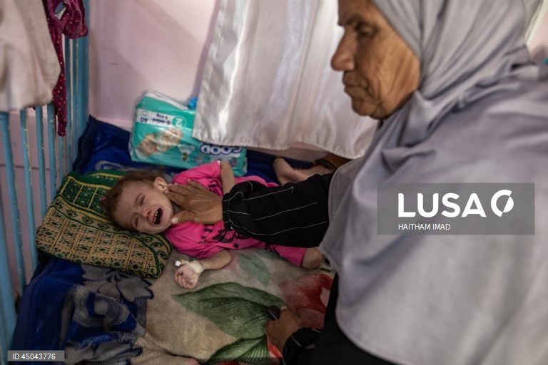 Faixa de Gaza: Tratamento de crianças desnutridas em Khan Yunis